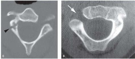 The Pediatric Cervical Spine Radiology Key