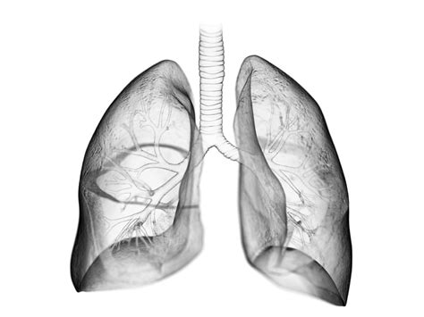 Investigating Susceptibility To Radiation Induced Pulmonary Fibrosis