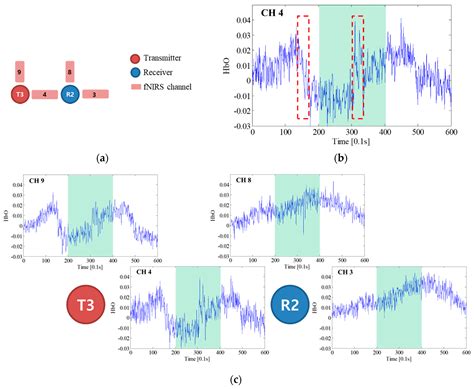 Sensors Free Full Text Motion Artifact Correction Of Multi Measured