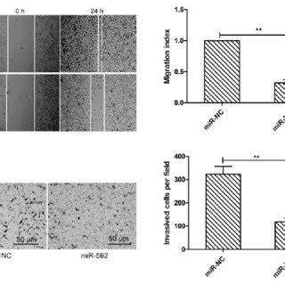 MiR 592 Inhibited Cell Migration And Invasion Of Glioma Cells A Cell