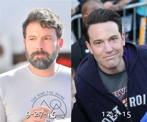 Ben Affleck Before And After Plastic Surgery 25 Celebrity Plastic