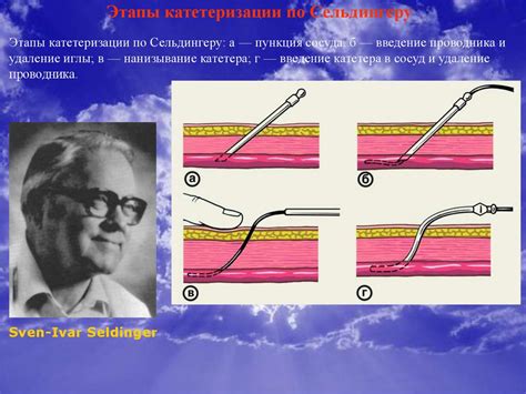 Внутривенные катетеры, алгоритм постановки и ухода. Пути профилактики ...