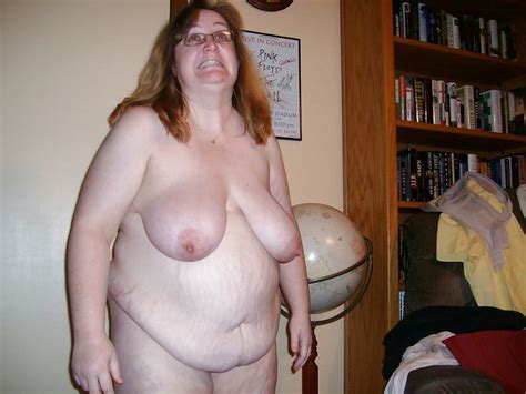 Les Salopes Fat Ugly Body Porn Pictures Xxx Photos Sex Images Pictoa