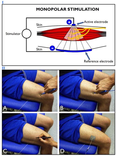 Muscle Motor Point Identification Is Essential For Optimizing