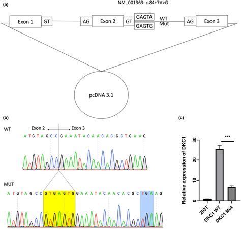 Functional change studies of the DKC1 c.84 + 7A > G mutation by ...