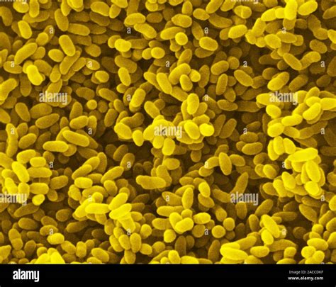 False Colour Scanning Electron Micrograph Of The Rod Shaped Gram