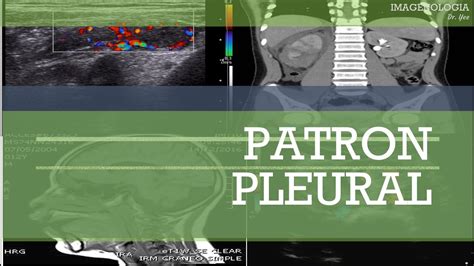 Patr N Pleural Youtube