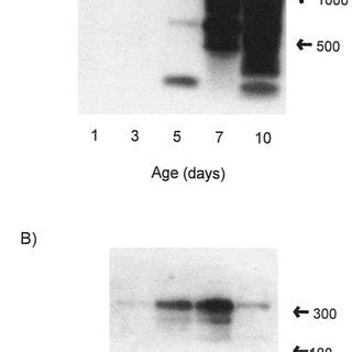 Southern Blot Hybridization Of PCR Products Obtained Using LH Receptor