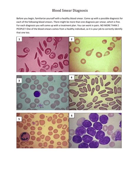 Blood Smear Diagnosis