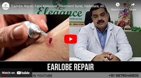 Otoplasty Earlobe Repair Elegance Clinic