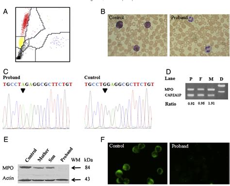 Figure 1 from A novel mutation in the myeloperoxidase gene in a Chinese ...