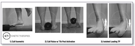 Tibialis Posterior Strengthening Flat Feet Exercises, 56% OFF