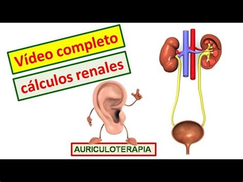 C Mo Tratar Los C Lculos Renales Con Auriculoterap A Centro Img Youtube