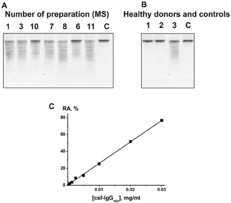 SDS PAGE Analysis Of MBP Hydrolyzing Activity Of Seven Individual IgGs