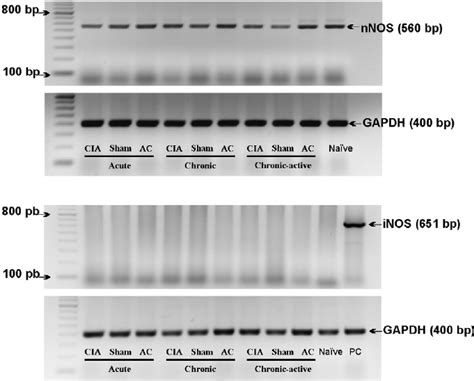 Analysis Of The Expression Of NNOS A And INOS B Using RT PCR In