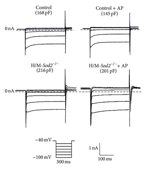 The Inward Rectifier K Current I K 1 Recorded From The Ventricular