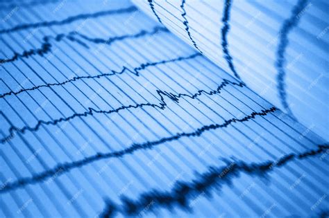 Registro Del Ritmo Cardíaco Sinusal En El Electrocardiograma Papel Que Muestra El Intervalo