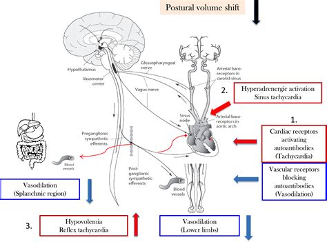 Postural Orthostatic Tachycardia Syndrome Clinical Presentation