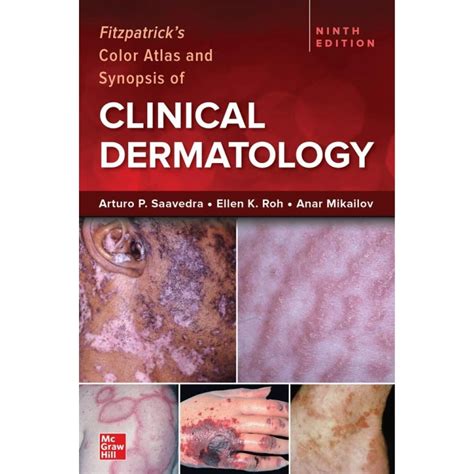 Dermatology Fitzpatrick S Color Atlas And Synopsis Of Clinical