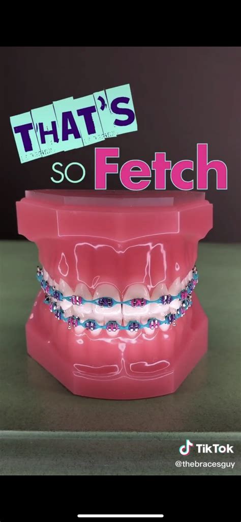 Braces Colors For Girls