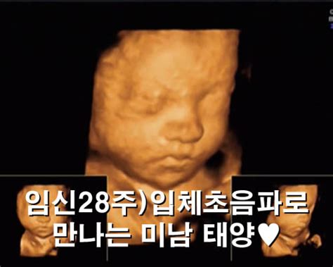 임신 28주 입체초음파로 만나는 미남 태양♡ 프라우메디 입체초음파 네이버 블로그