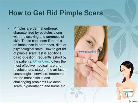 Ppt Find Remedy For Cure Pimples Powerpoint Presentation Free