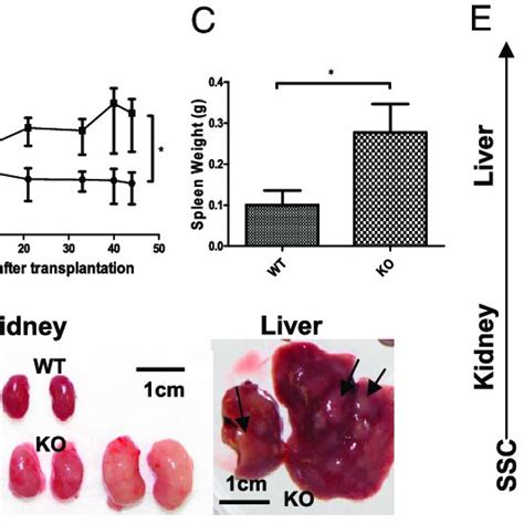 Myeloid Sarcoma Is Transplantable Into Immunocompromised Rag2 −− γc