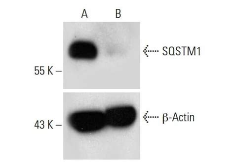 Sqstm P Crispr H Scbt Santa Cruz Biotechnology