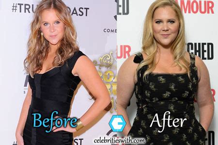 Amy Schumer Weight Gain, Plastic Surgery, Before and After Pictures - CelebritiesWith.com