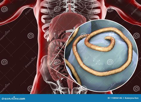 Helminths Nematodes Enterobius In The Gut Stock Illustration