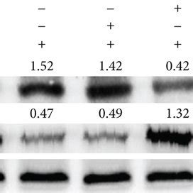 Pge Upregulates Ccr Expression Via Regulation Of Lxr And Notch A