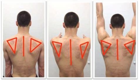 Three Different Angles Of The Back Of A Man S Head And Neck With Arrows