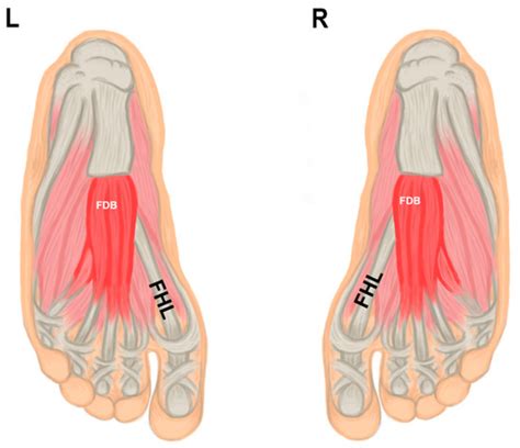 Anatomia Free Full Text A Missing Flexor Digitorum Brevis Tendon And Its Relationship To Sex