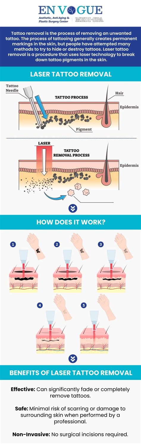 Tattoo Removal Near Me in Southampton, PA, and Langhorne, PA