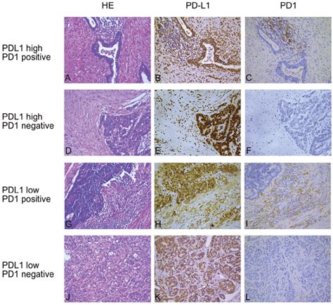 Representative Hematoxylin Eosin H E And Immunohistochemical Ihc