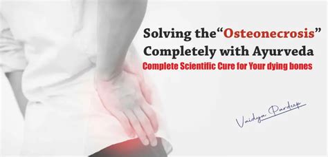 Osteonecrosis Avoid Total Hip Replacement With Ayurveda