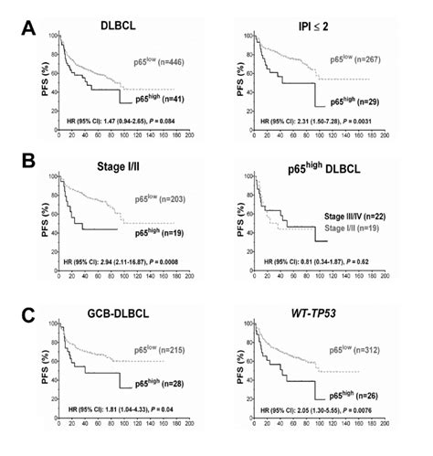 Prognosis for p65 hyperactivation in diffuse large B-cell lymphoma ...