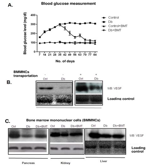 Blood Glucose Level Before And After BMMNC Transplantation In Diabetic