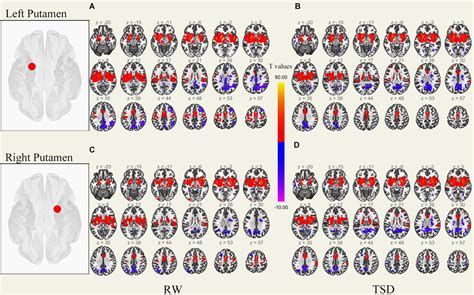 Frontiers Altered Functional Connectivity In The Resting State