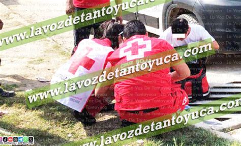 Mujer Queda Atrapada En Rejilla Del Drenaje Pluvial Diario La Voz De