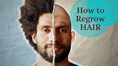 How To Regrow Hair On Bald Spot