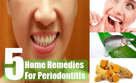 5 Home Remedies For Periodontitis Natural Cure And Herbal Treatment For