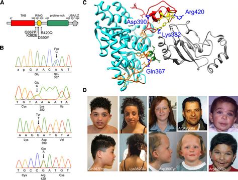 Germline Cbl Mutations Underlying Noonan Syndrome And Related