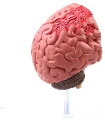 Buy Human Brain Humans Brain Disease Model Anatomical Model Of