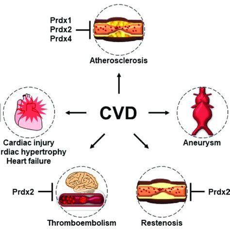 The Protective Roles Of Prdxs In The Pathogenesis Of CVD Prdx 1 2