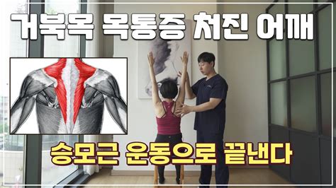 거북목 목통증 처진어깨 교정 승모근 운동 하나로 해결해 보세요 Youtube