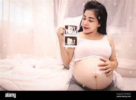 Close Up Of A Beautiful Pregnant Woman Holding An Ultrasound Scan A