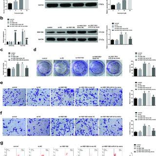 Mir P Mimicking Suppresses S Htr Svneo Cell Progression A Rt Qpcr