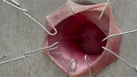 Cbt Nude Pics Xhamster