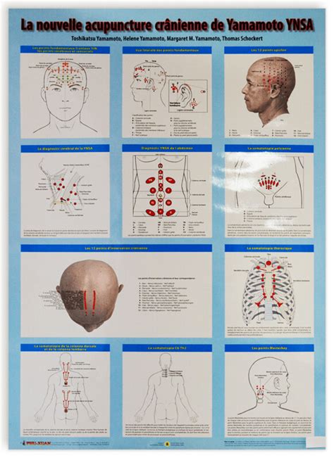 Planche De La Nouvelle Acupuncture Cr Nienne De Yamamoto Ynsa